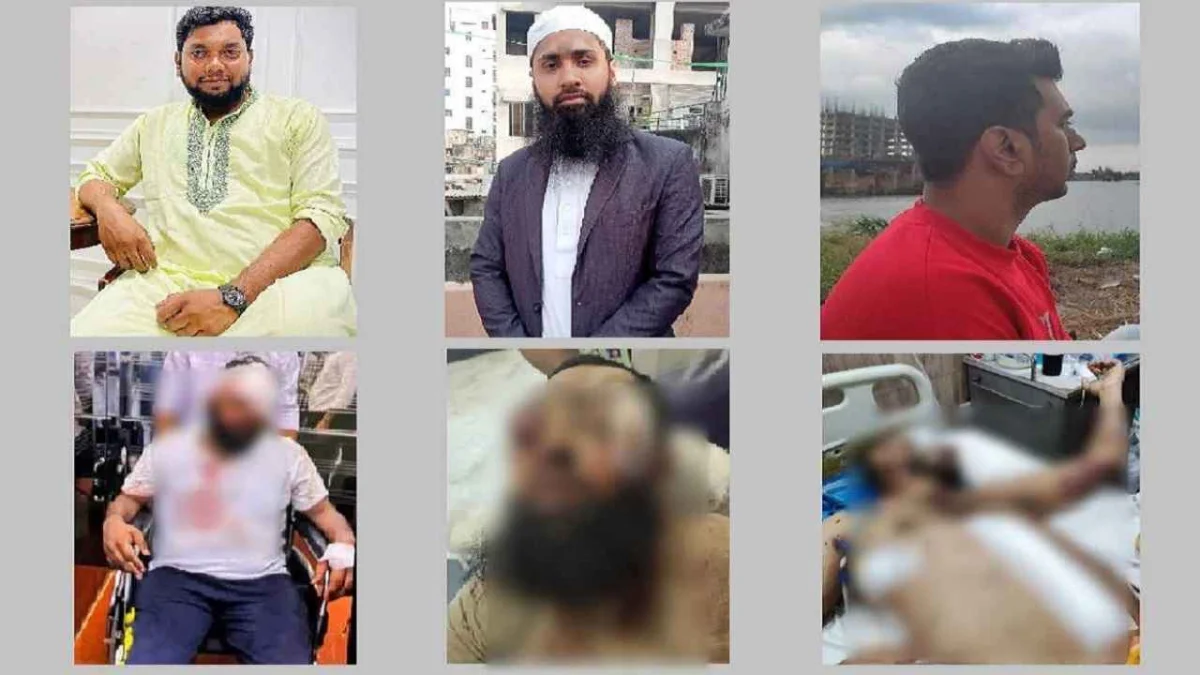 চোখ হারিয়ে জীবনযুদ্ধে তিন জুলাইযোদ্ধা