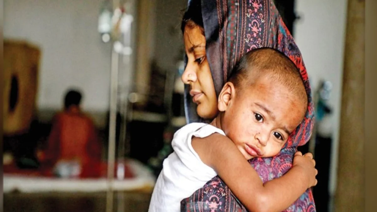 হাম ও উপসর্গে আরও ৫ শিশুর মৃত্যু