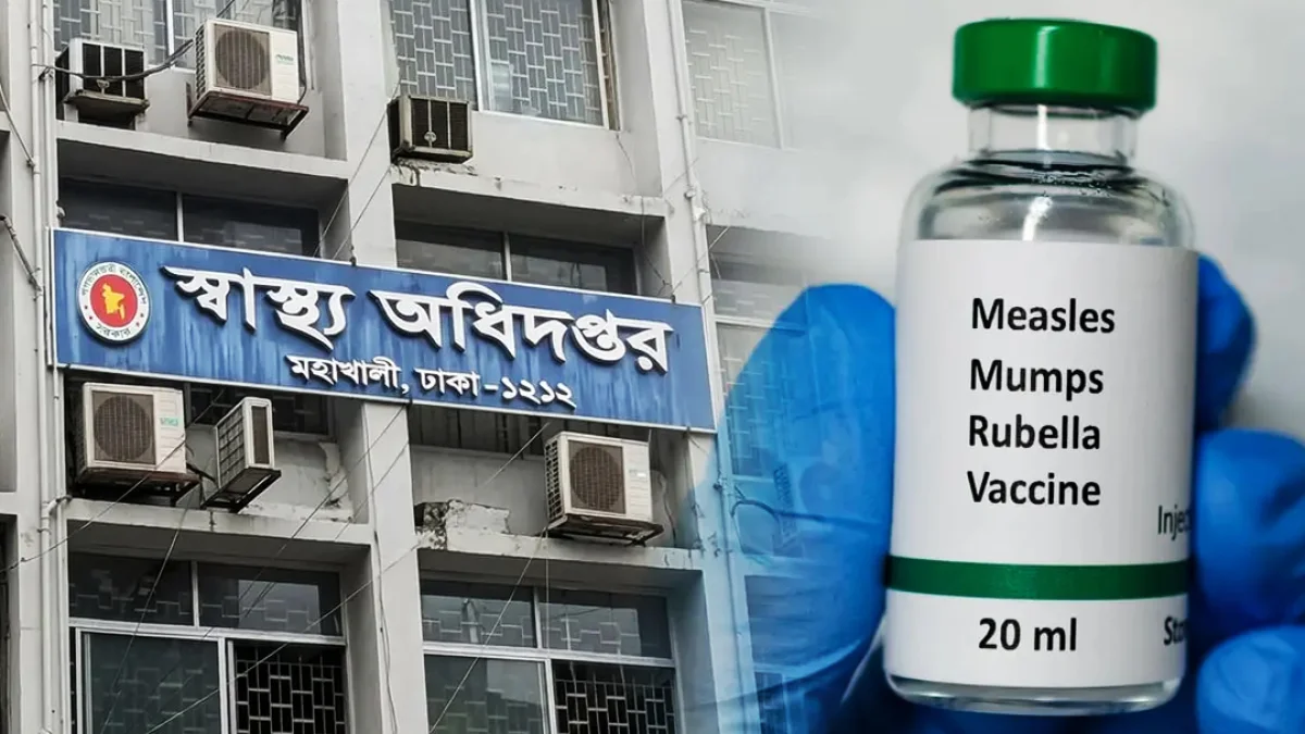 হামের উপসর্গে আরও ৫ জনের মৃত্যু, আক্রান্ত ১১৮০